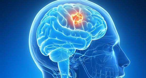 Combination immunotherapy of glioblastoma with dendritic cell  cancer vaccines, anti-PD-1 and poly I:C